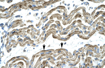 C13ORF8 Rabbit Polyclonal Antibody