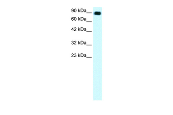 C13ORF8 Rabbit Polyclonal Antibody