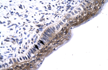 MAP3K7IP2 Rabbit Polyclonal Antibody