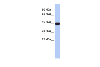 NEUROD4 Rabbit Polyclonal Antibody