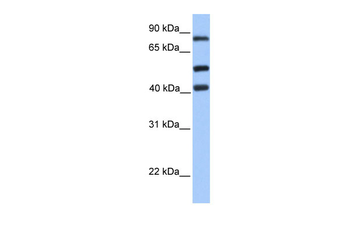 HCFC2 Rabbit Polyclonal Antibody