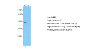 ACAT2 Rabbit Polyclonal Antibody
