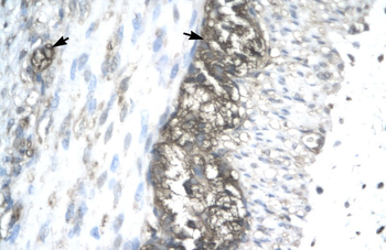 ACAT2 Rabbit Polyclonal Antibody