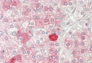 HTATIP Rabbit Polyclonal Antibody