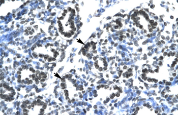 CLDN17 Rabbit Polyclonal Antibody
