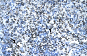 CLDN17 Rabbit Polyclonal Antibody