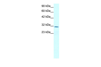 CLDN17 Rabbit Polyclonal Antibody