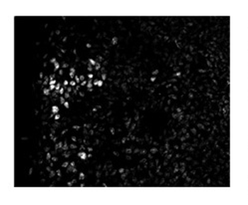 ZFHX1B Rabbit Polyclonal Antibody