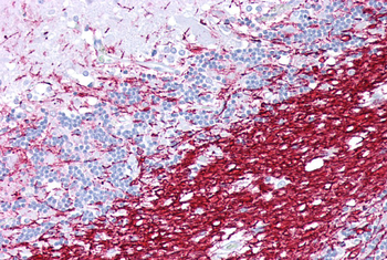 PLP1 Rabbit Polyclonal Antibody