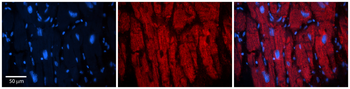 KIF23 Rabbit Polyclonal Antibody