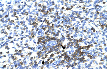 RCOR3 Rabbit Polyclonal Antibody