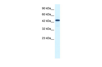 RCOR3 Rabbit Polyclonal Antibody