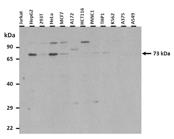 CRSP6 Rabbit Polyclonal Antibody
