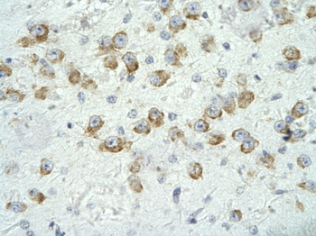 CRSP6 Rabbit Polyclonal Antibody