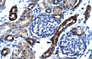 DXYS155E Rabbit Polyclonal Antibody