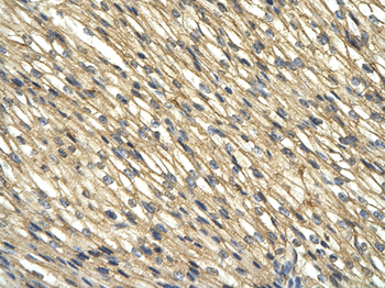 WDR39 Rabbit Polyclonal Antibody