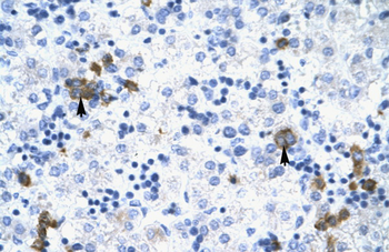 TRIM17 Rabbit Polyclonal Antibody
