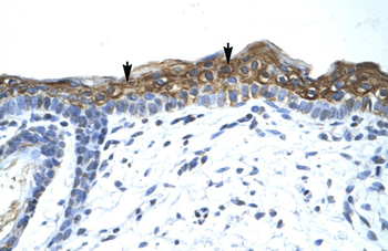 KMT5B Rabbit Polyclonal Antibody