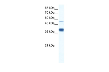 DKFZP781I1119 Rabbit Polyclonal Antibody