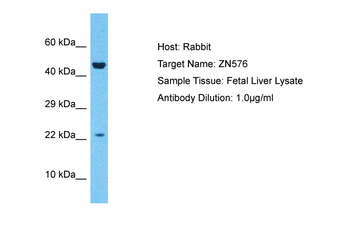 ZNF576 Rabbit Polyclonal Antibody