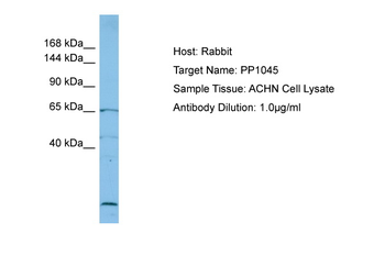 RECQL5 Rabbit Polyclonal Antibody