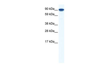 ZFY1 Rabbit Polyclonal Antibody