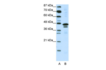 WDR39 Rabbit Polyclonal Antibody