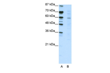 CBFA2T3 Rabbit Polyclonal Antibody