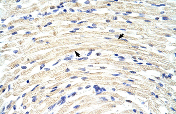 HTATIP Rabbit Polyclonal Antibody