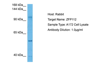 ZNF112 Rabbit Polyclonal Antibody