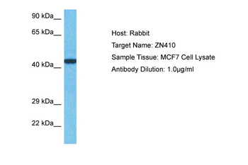 ZNF410 Rabbit Polyclonal Antibody