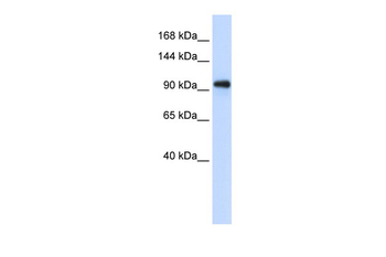 EXOSC10 Rabbit Polyclonal Antibody