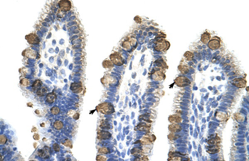 EXOSC3 Rabbit Polyclonal Antibody