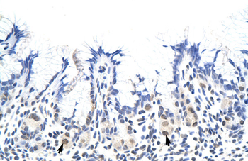 HNRNPA1L2 Rabbit Polyclonal Antibody