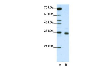 HNRNPA1L2 Rabbit Polyclonal Antibody