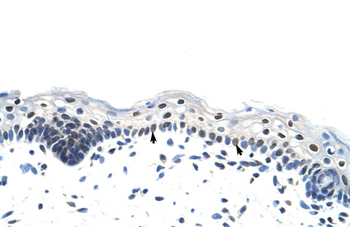 RP11-78J21.1 Rabbit Polyclonal Antibody