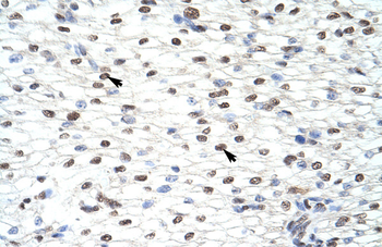 CUGBP2 Rabbit Polyclonal Antibody