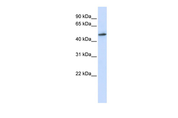 RNMT Rabbit Polyclonal Antibody