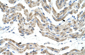 SFRS10 Rabbit Polyclonal Antibody