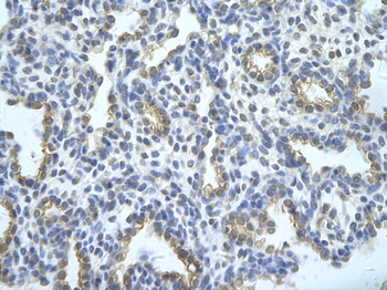 SFRS10 Rabbit Polyclonal Antibody
