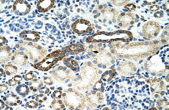 HNRPF Rabbit Polyclonal Antibody