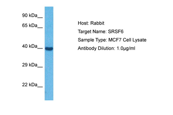 SFRS6 Rabbit Polyclonal Antibody