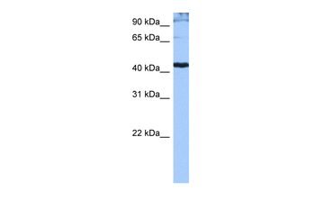 SFRS6 Rabbit Polyclonal Antibody