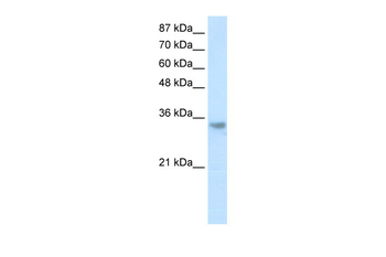 RNASEH2A Rabbit Polyclonal Antibody