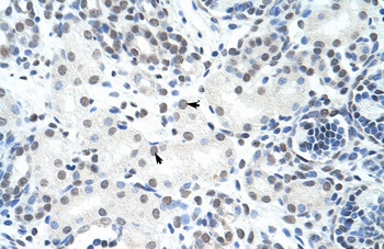 HNRPH3 Rabbit Polyclonal Antibody
