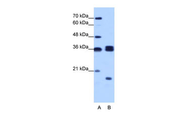 HNRPH3 Rabbit Polyclonal Antibody