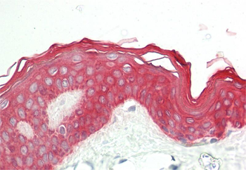 KRT2A Rabbit Polyclonal Antibody