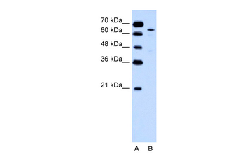 KRT2A Rabbit Polyclonal Antibody