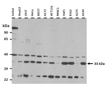 TST Rabbit Polyclonal Antibody