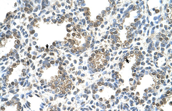 TST Rabbit Polyclonal Antibody